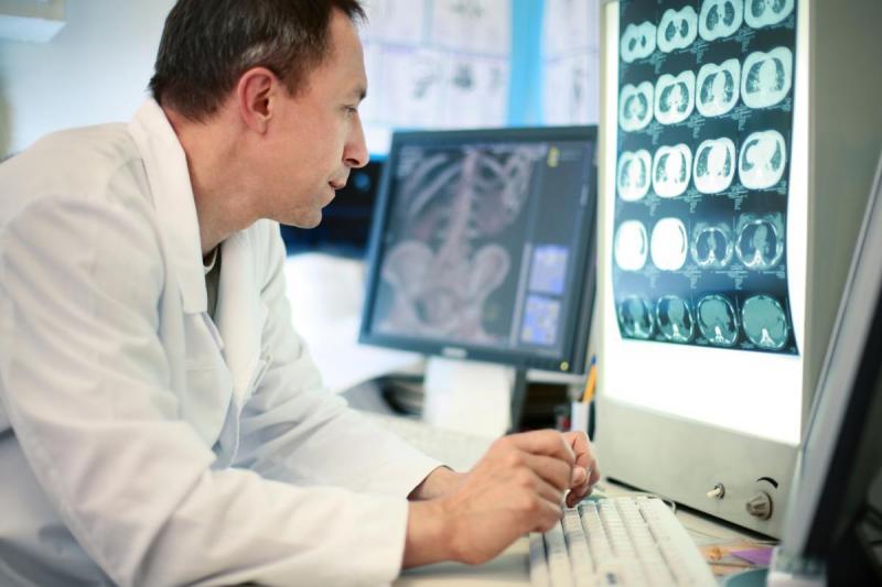 A medical professional studies an MRI brain scan