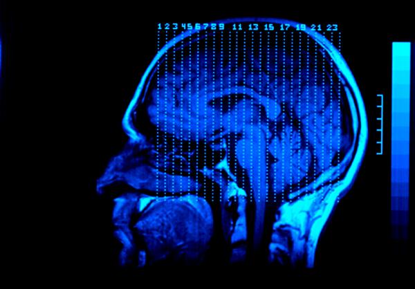 10 Warning Signs of a Brain Injury After an Accident | Prescott